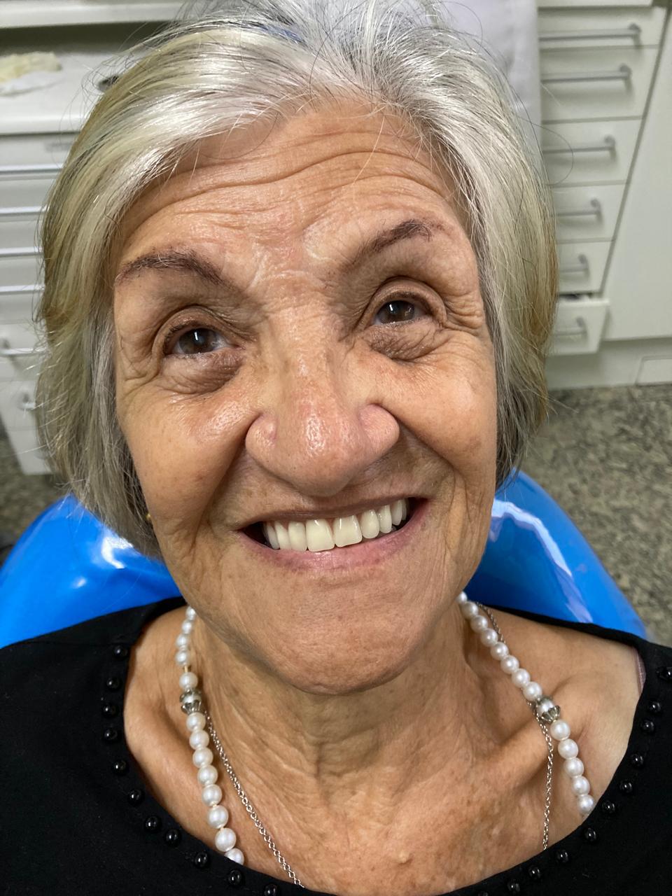 Antes e depois — reabilitação do sorriso