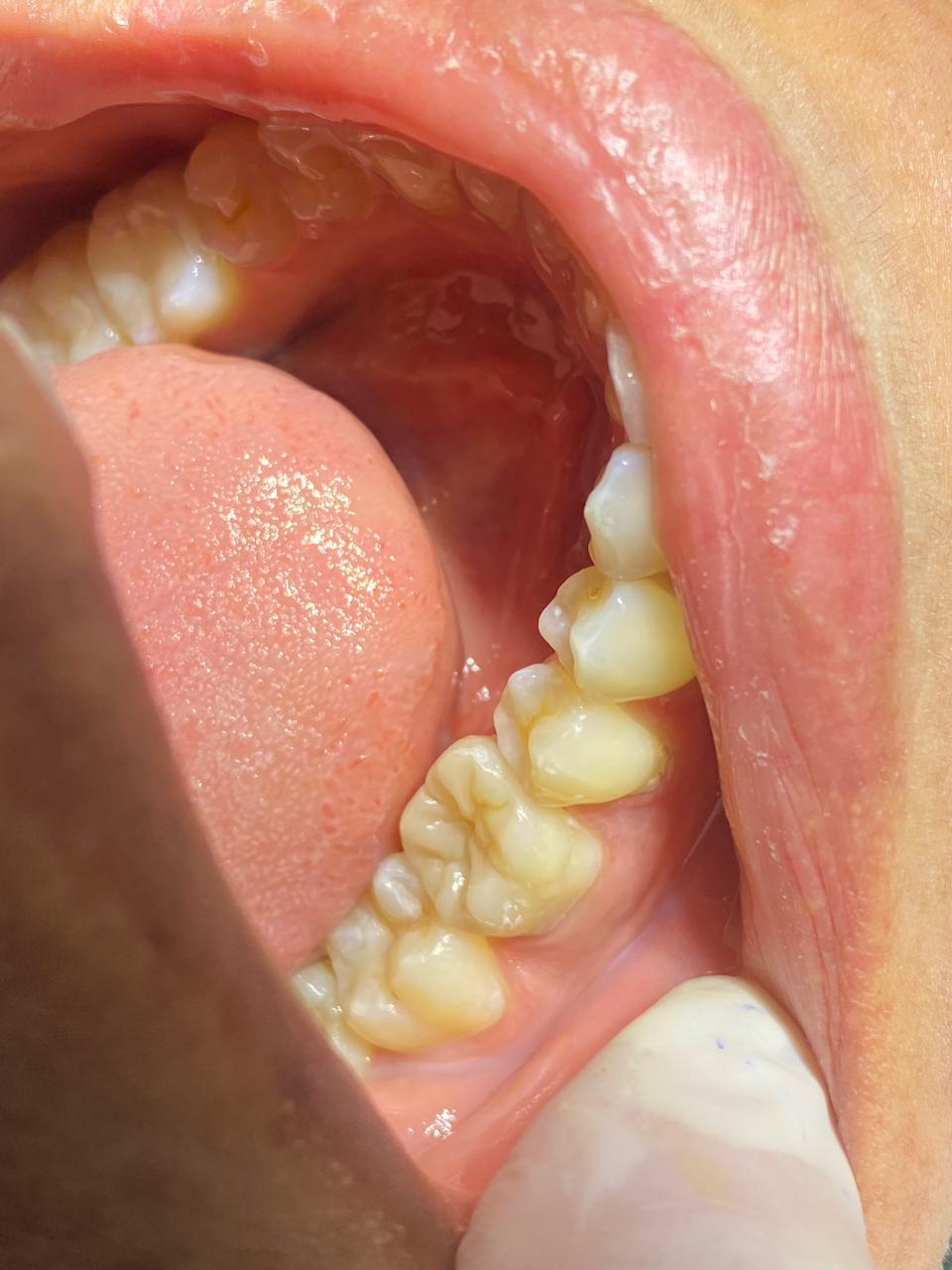 Antes e depois — transformação do sorriso